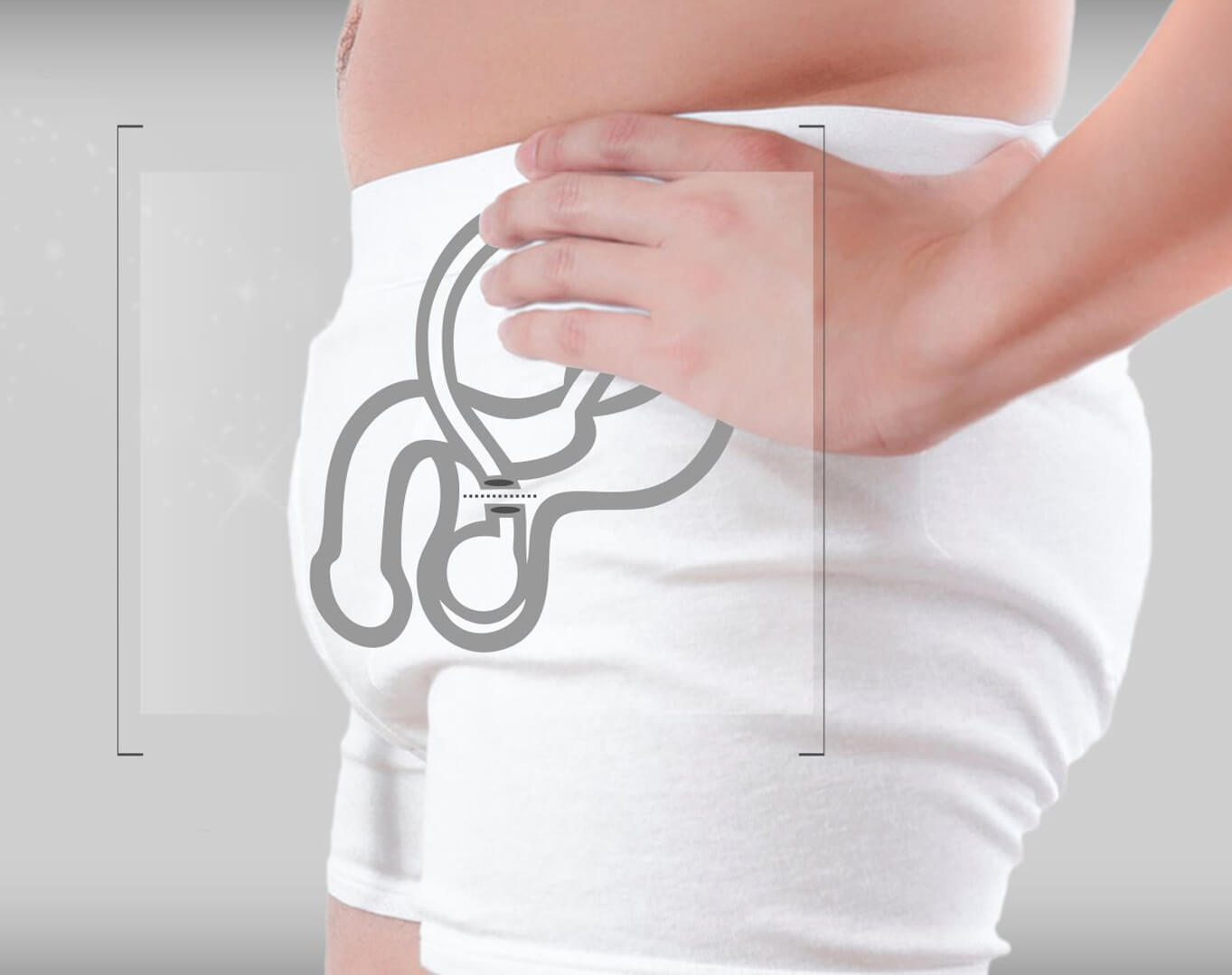 Clínicas con cirugía de vasectomía en Hidalgo